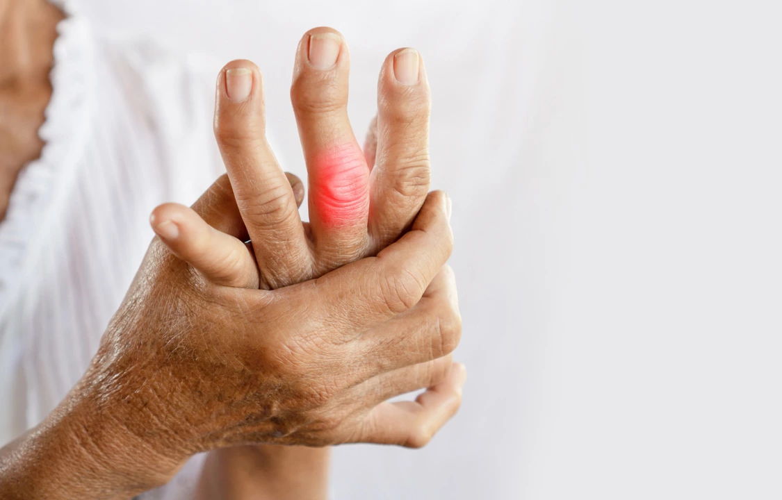 Amlodipine and Gout: What Patients with Joint Pain Should Know